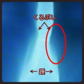 レントゲンっぽくパチリ